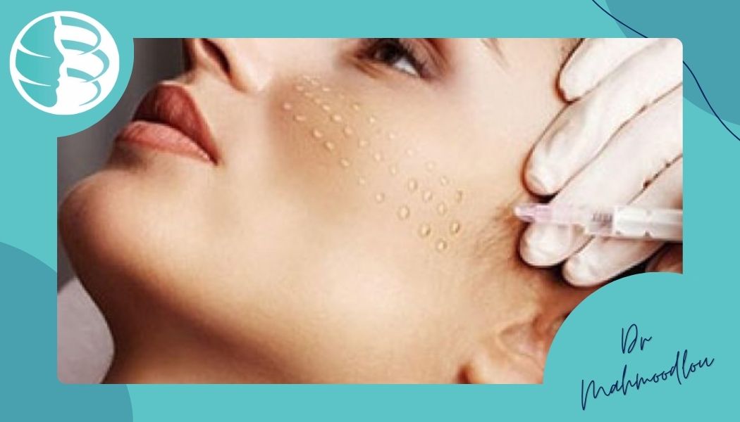 راهنمای کامل مراقبت بعد از مزوژل راهنمای کامل مراقبت بعد از مزوژل