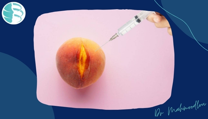 آیا تزریق فیلر واژن برای جوانسازی موثر است؟ مزایا و عوارض