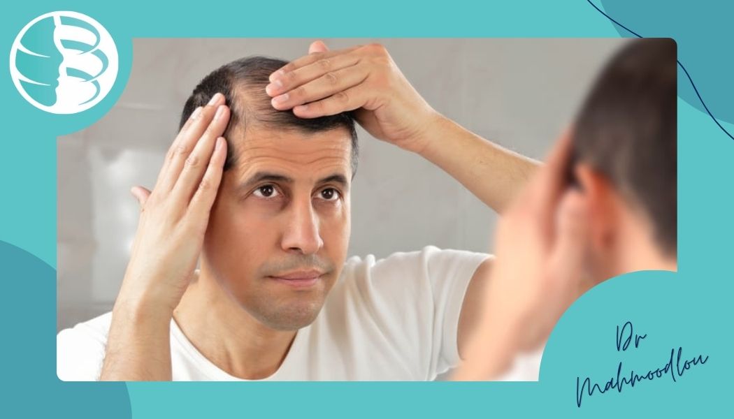 چالش‌های مزوتراپی پس از کاشت مو
