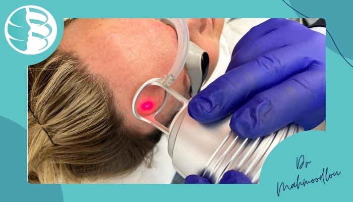 تاثیر لیزر CO2 در جوانسازی پوست تاثیر لیزر CO2 در جوانسازی پوست