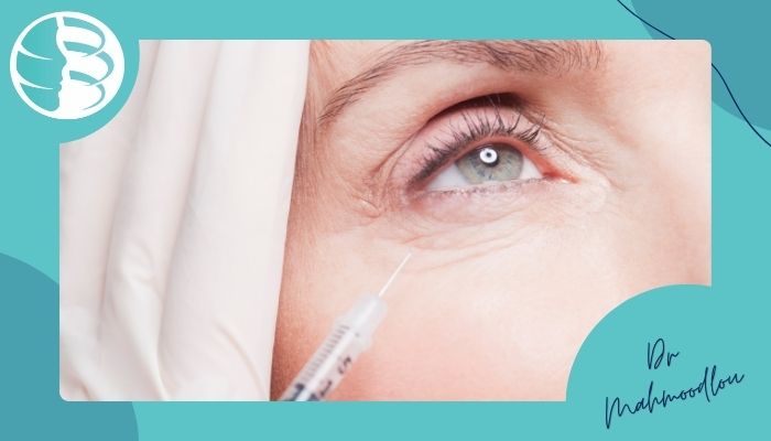 علت کبودی بعد از تزریق فیلر زیر چشم علت کبودی بعد از تزریق فیلر زیر چشم