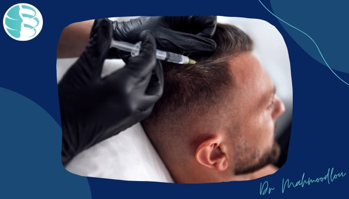 درمان ریزش مو با مزوتراپی چه نوع درمانی است؟