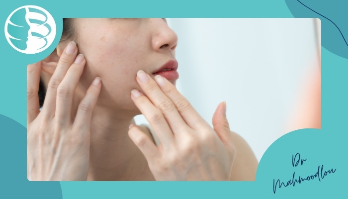 علل ایجاد منافذ صورت