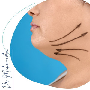 عوارض احتمالی عوارض احتمالی