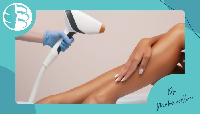 لیزر موهای زائد پوست‌های تیره