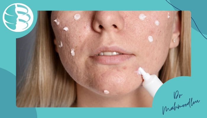 مراقبت‌های بعد از درمان برای جلوگیری از بازگشت