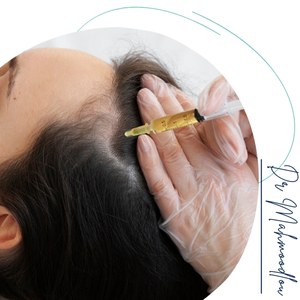 مزایا تقویت مو با اس‌وی‌اف