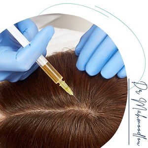 معایب و محدودیتها معایب و محدودیتها