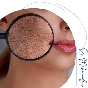 معایب و محدودیت‌ها