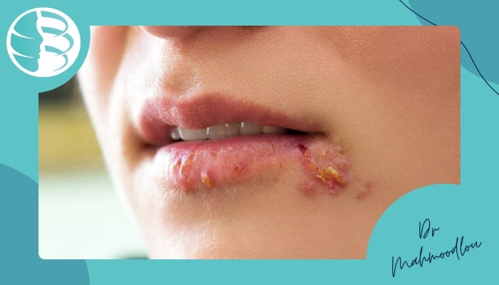 موارد منع انجام و احتیاط موارد منع انجام و احتیاط