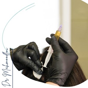 مکانیسم عملکرد SVF در پوست سر