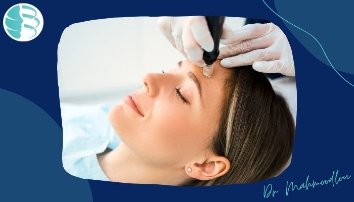 میکرونیدلینگ چگونه انجام می شود و مزایا و معایب آن چیست؟ میکرونیدلینگ چگونه انجام می شود و مزایا و معایب آن چیست؟