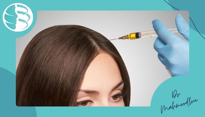 نحوه درمان ریزش مو با روش SVF
