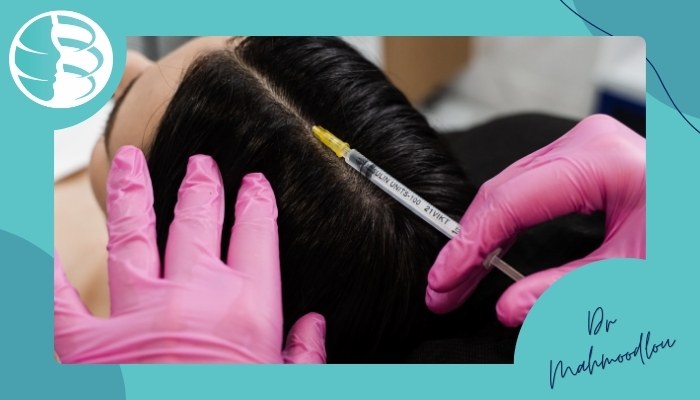 نحوه درمان ریزش مو با مزوتراپی