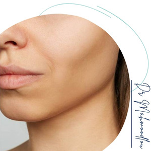 هزینه اصلاح فرم صورت هزینه اصلاح فرم صورت