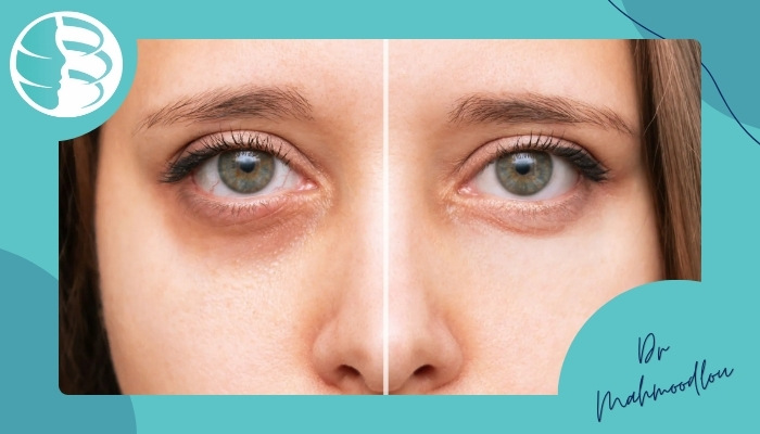 راهکارهای پیشگیری راهکارهای پیشگیری