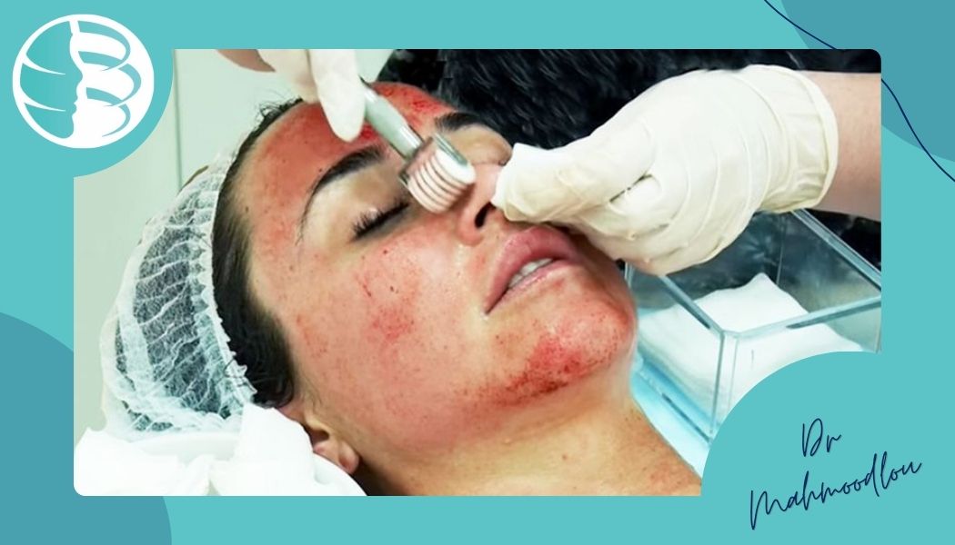 چگونه جای جوش را به‌صورت تخصصی درمان کنیم؟