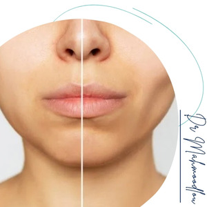 کاندیداهای مناسب کاندیداهای مناسب