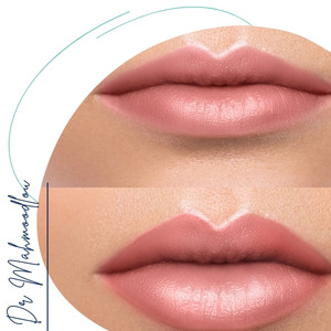 چه افرادی بهترین کاندید هستند؟