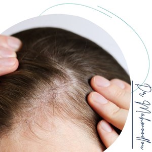 کاندیدای مناسب