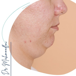 کاندیدای مناسب کاندیدای مناسب